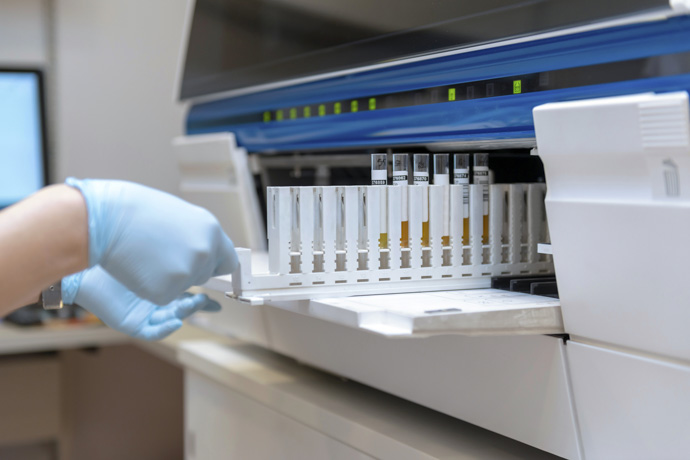 Máquina para analizar pruebas de orina