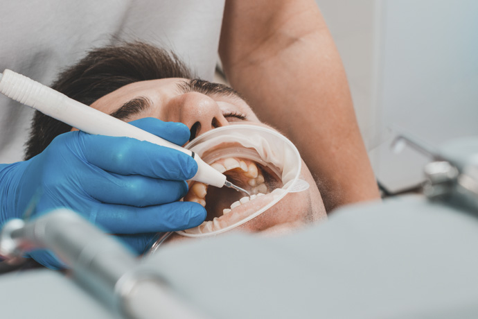 Persona con problemas dentales por sarro