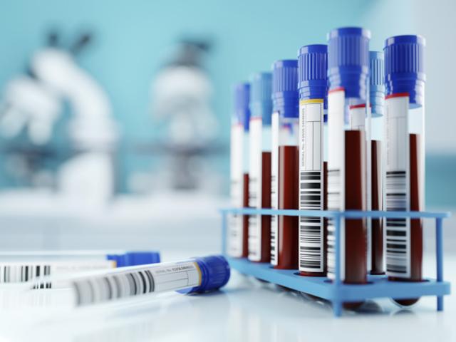 Muestras de sangre para BRCA1