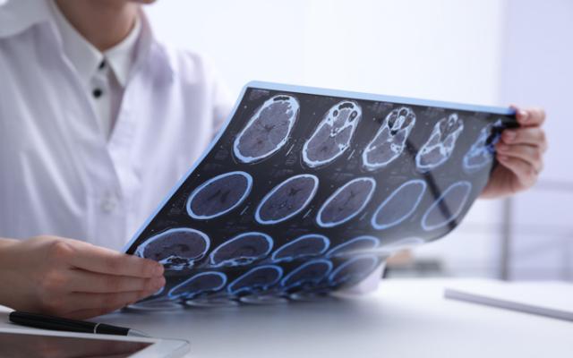 Médico analizando los avances de una esclerosis múltiple en un paciente.